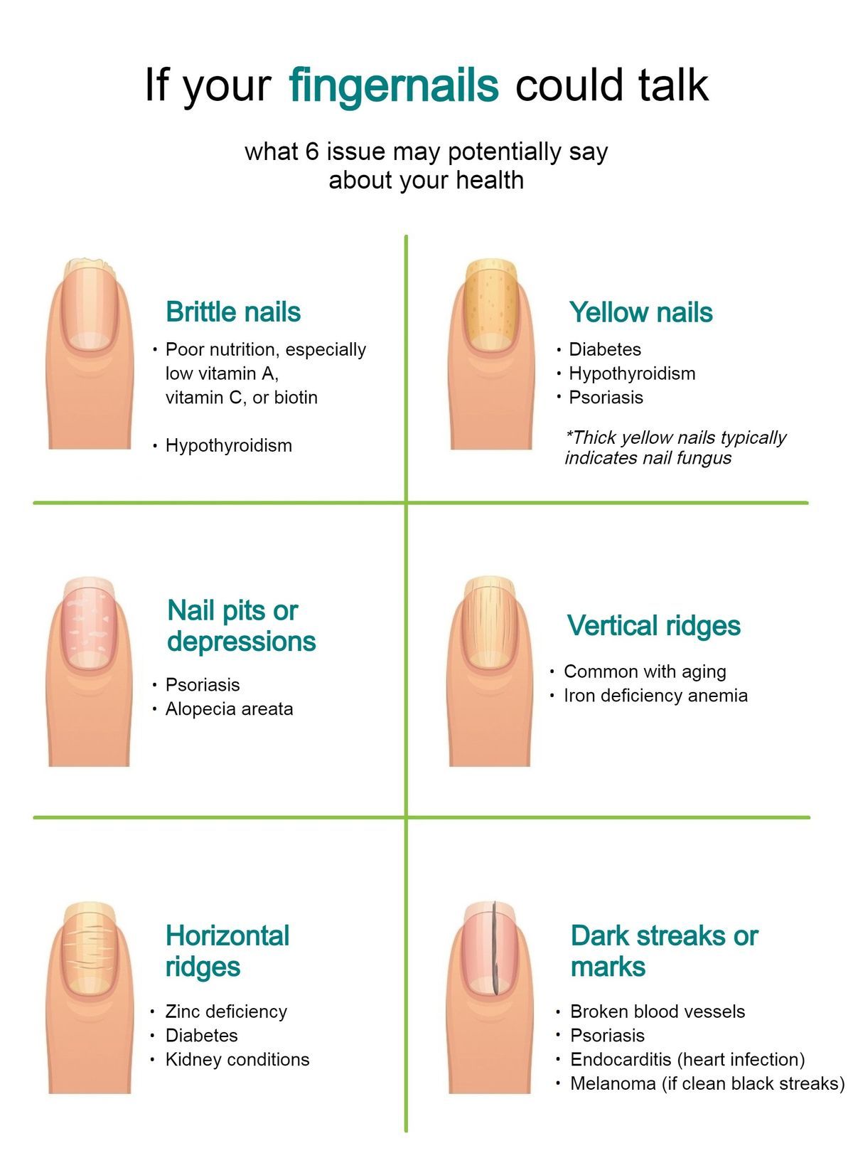 Nail Treatment Infographic.jpg