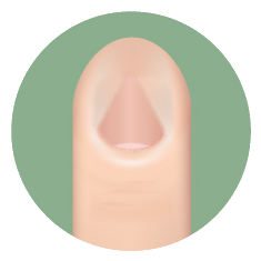 Triangle nail