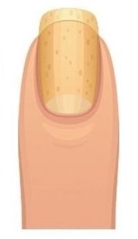 image of yellow nails