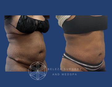 Patient 34 Right oblique.jpg