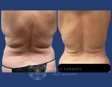 Patient 13 Posterior .jpg