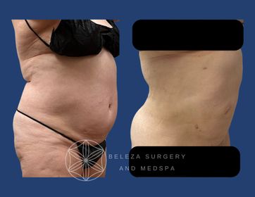 Patient 13 Right OBlique.jpg