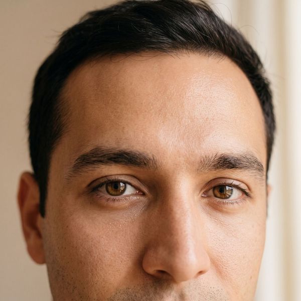 Male Facial Contouring 1.jpg