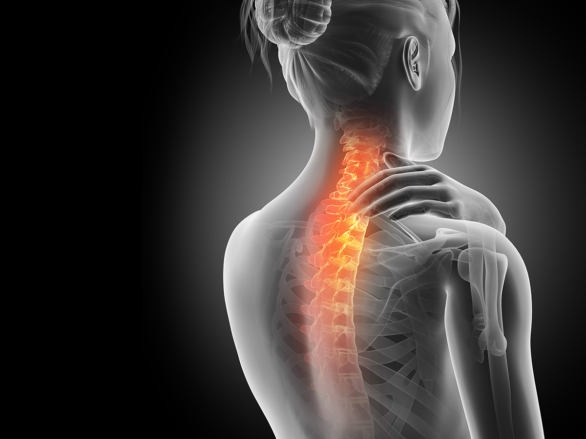 X-ray of woman experiencing pain in her neck. X-ray of woman experiencing pain in her neck.