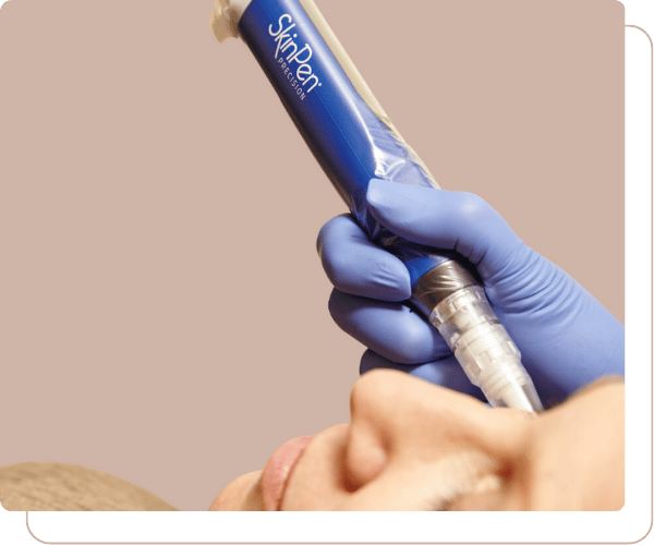 2 Microneedling.png