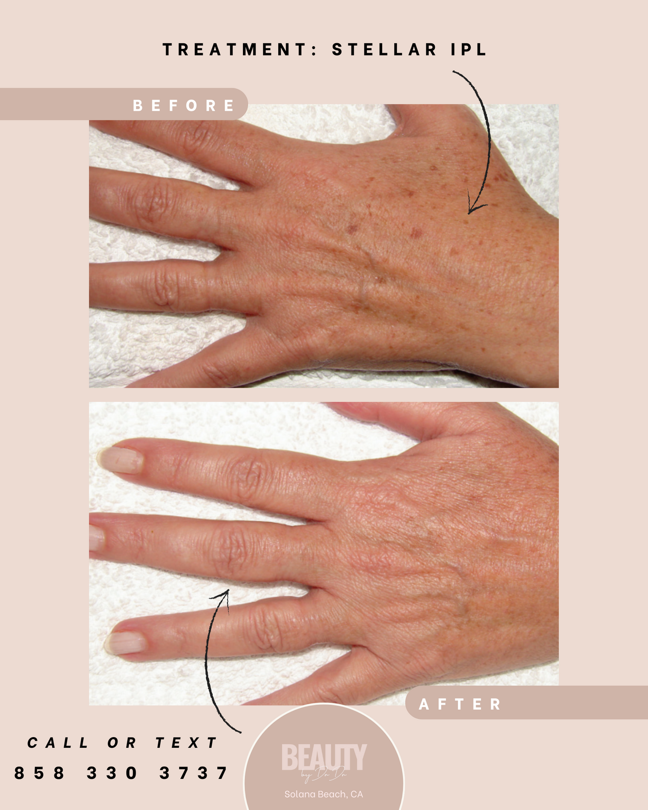 Hand before and after.png