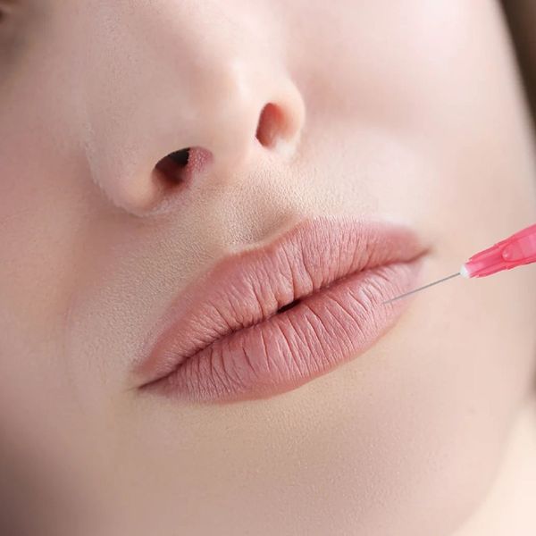 A woman getting lip filler