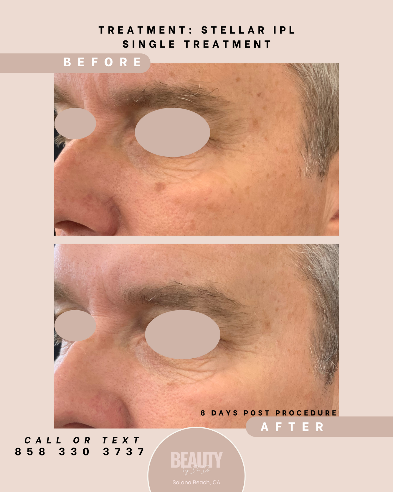 Face before after.png