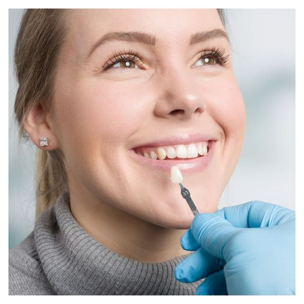 dentist holding up venner to womans teeth