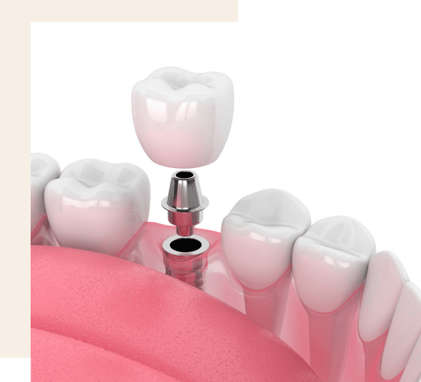 Dental diagram