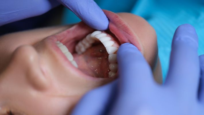 M38844 - Gentle Oral Surgery Care Hero Image.jpg