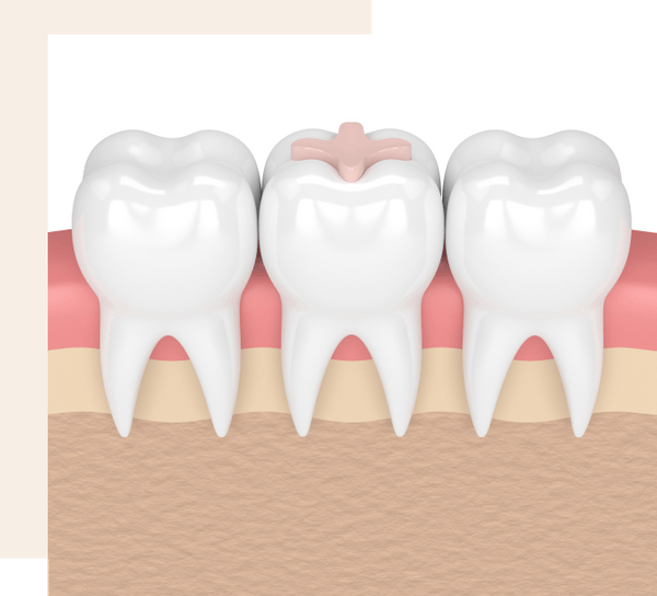 Dental diagram