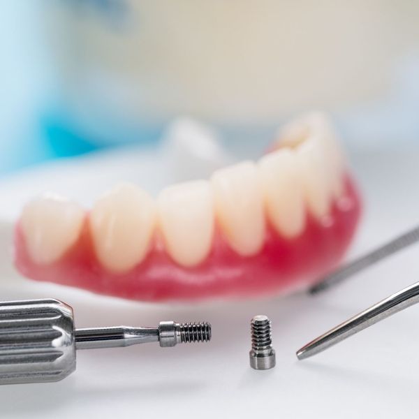dental implant next to mouth model