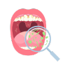 Oral Infection.png