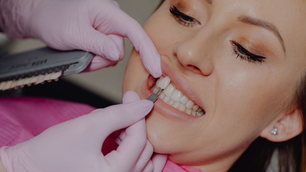 woman getting veneers