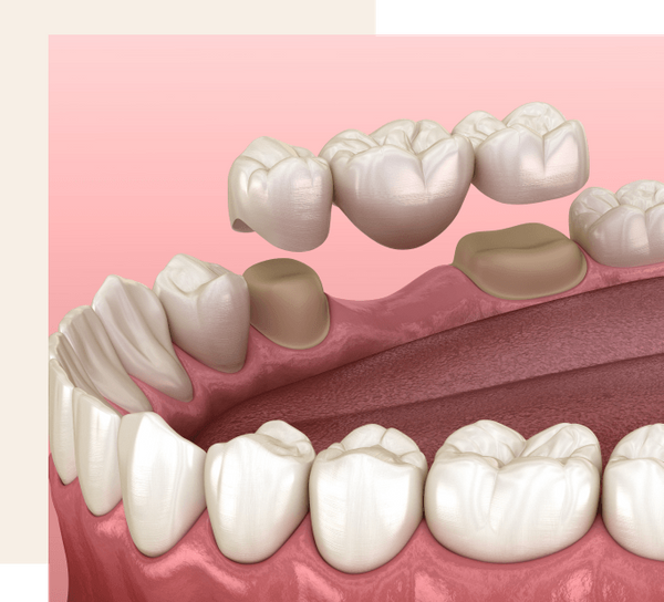 Dental diagram