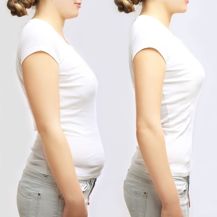 before and after medical weight loss