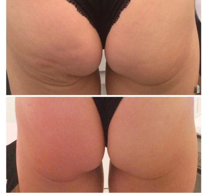 tshape2 buns.jpg