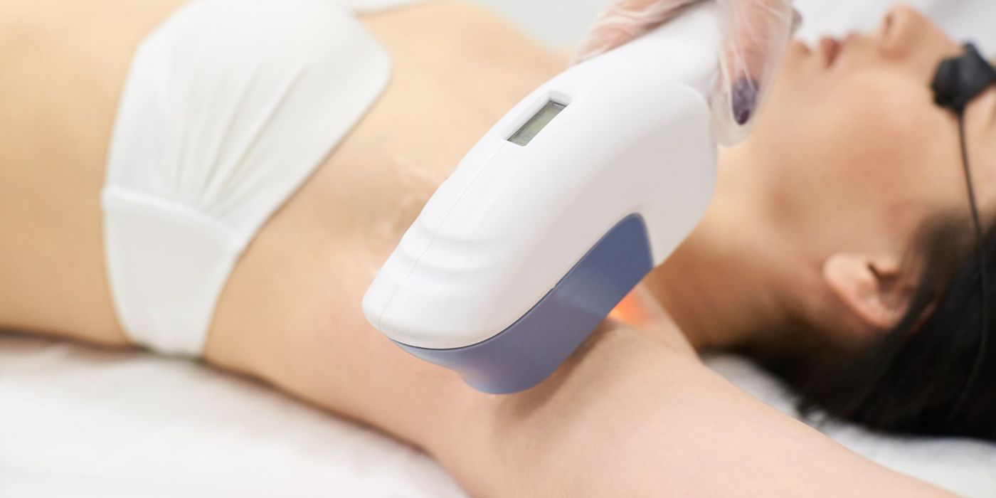 laser hair removal