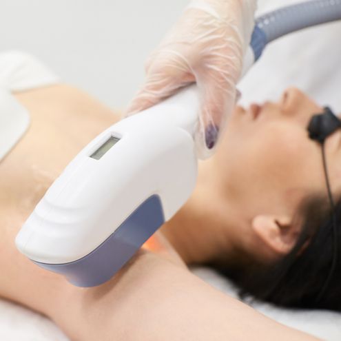 woman getting laser hair removal on armpit