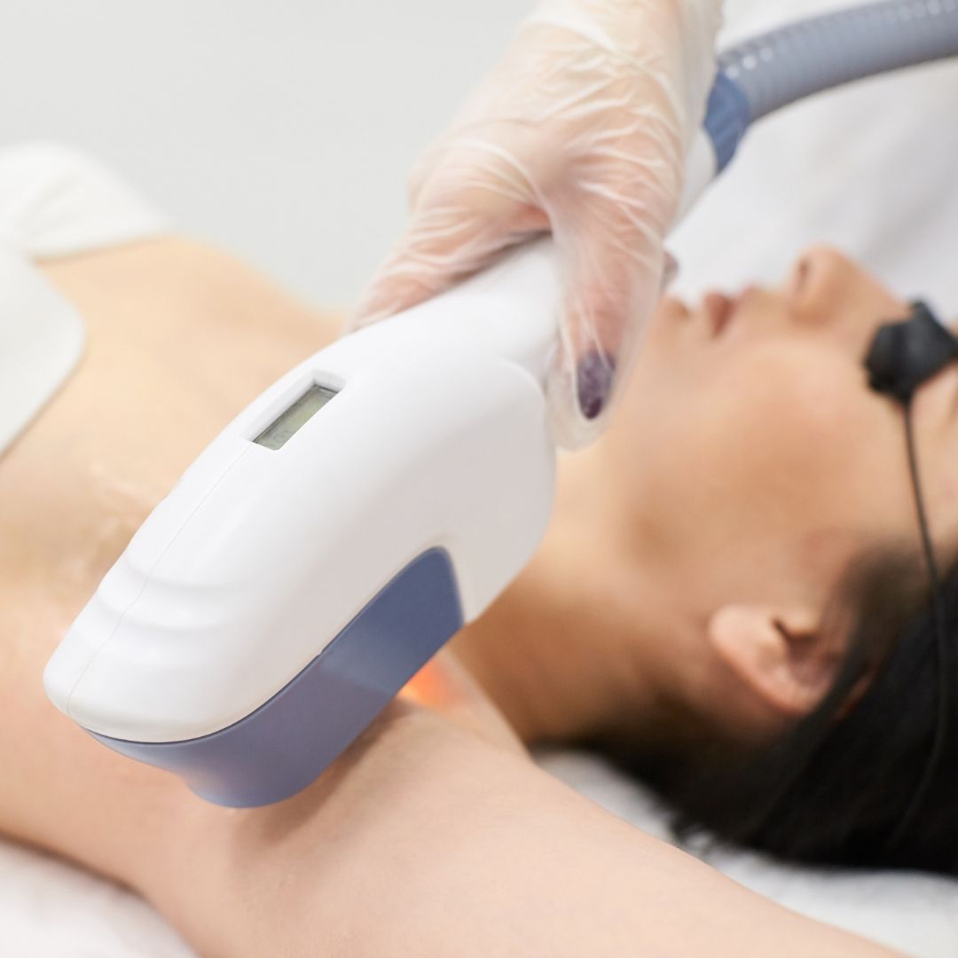 woman getting laser hair removal on armpit