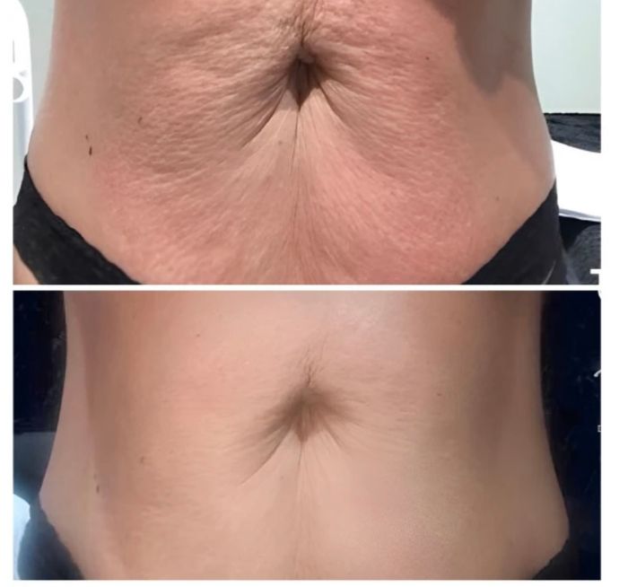Tshape abs.jpg