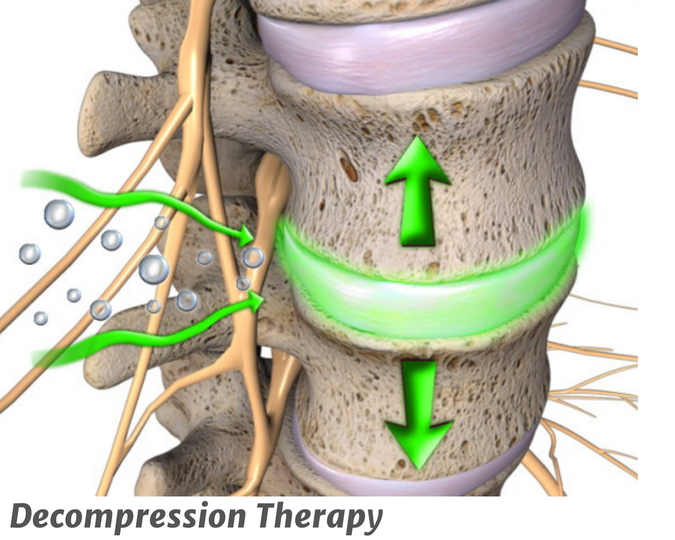 DECOMPRESSION THERAPY