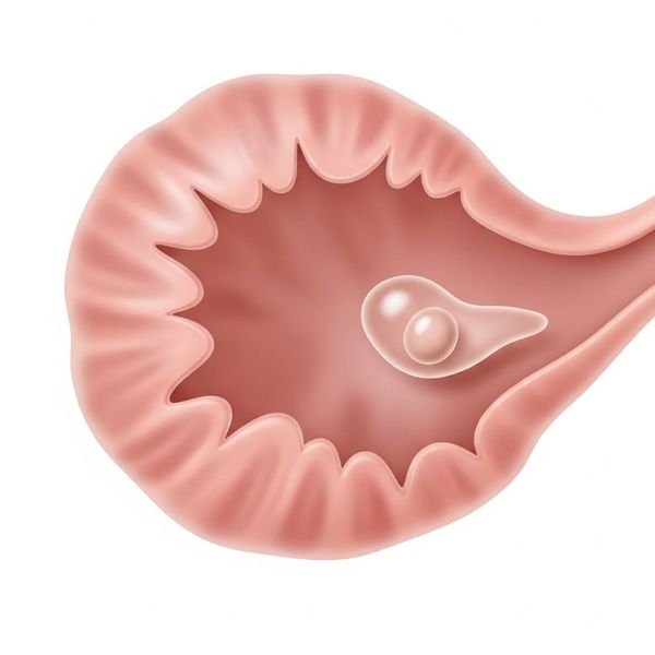 medical illustration focusing on the ovaries with a small, benign cyst