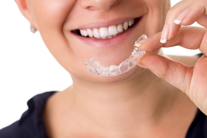 Invisalign teeth straighter