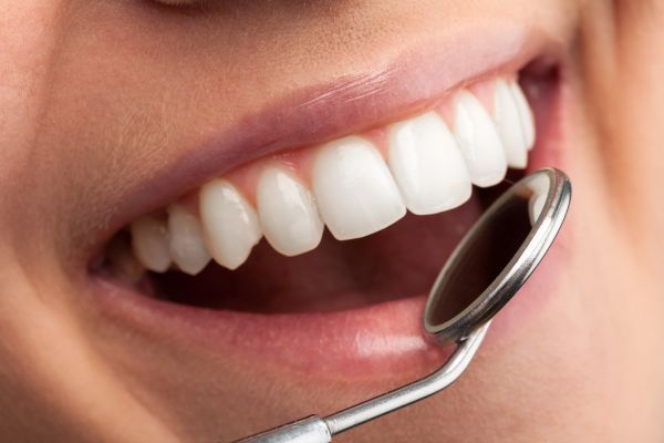 Benefits of Dental Crowns.jpg