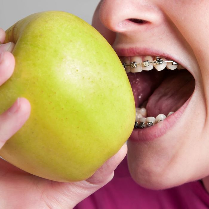 eating apple with braces