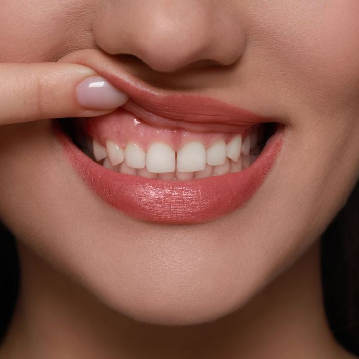 closeup of gums