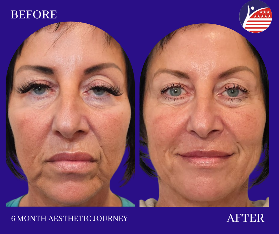 before and after 6 month journey 