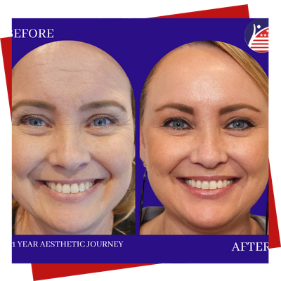 A before & after treatment photo, showing brighter, healthier looking skin.