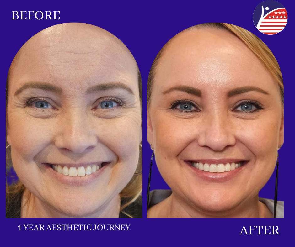 before and after 1 year 