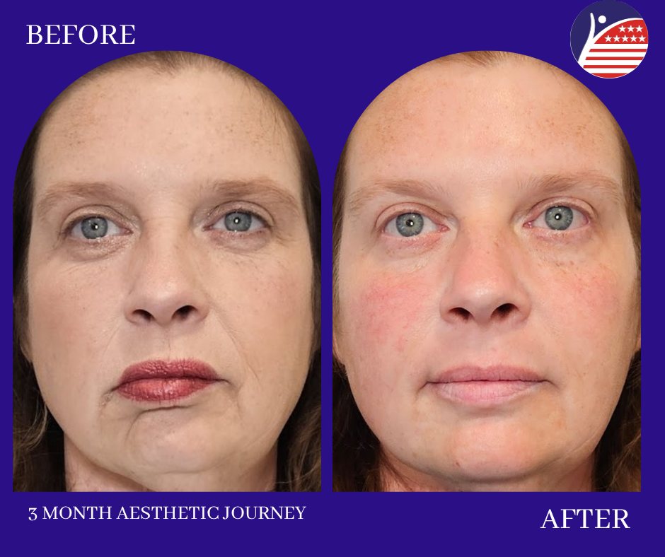 before and after 3 months 