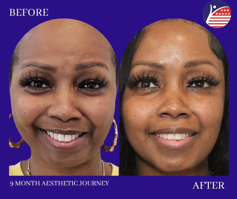 before and after photos 9months