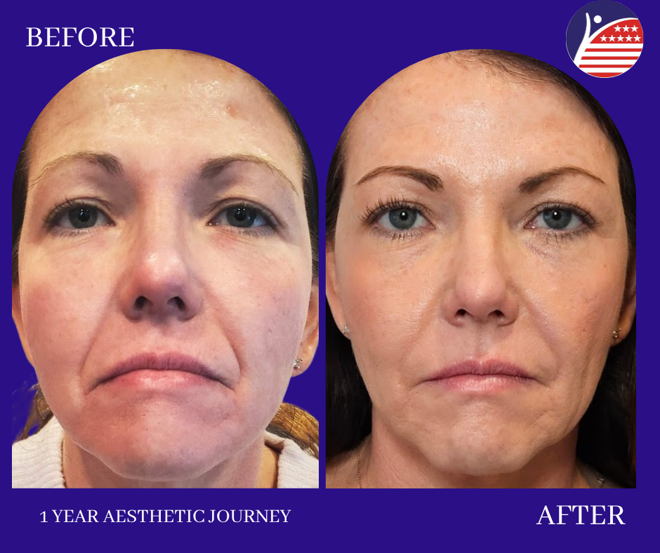 before and after 1 year journey 