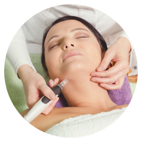 Micro-Needling Treatments 2.png
