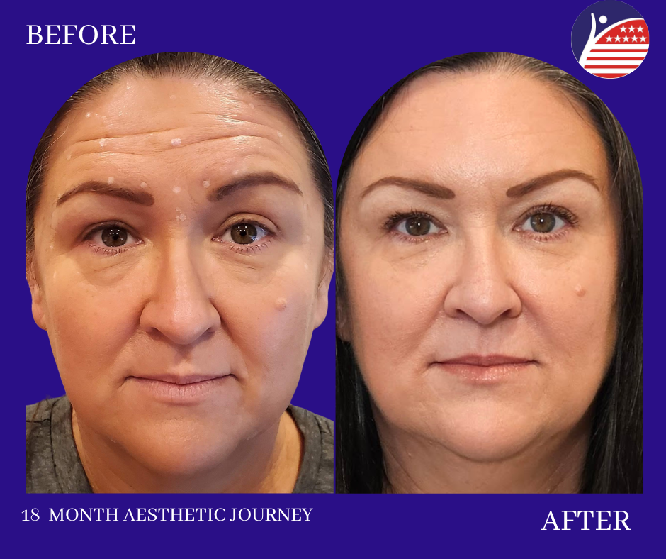 before and after photos 18 months 