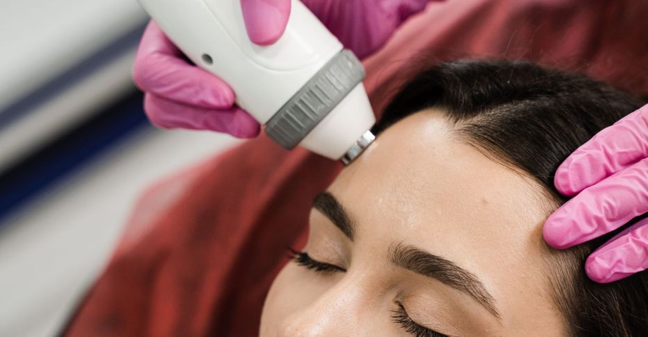 Morpheus8 Radiofrequency Micro-Needling Blog Hero.jpg