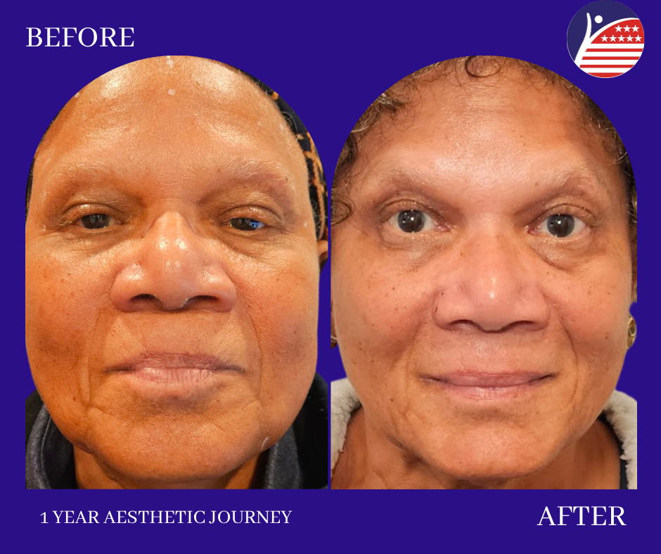 before and after 1 year journey 