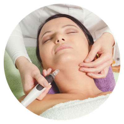 A micro needling treatment