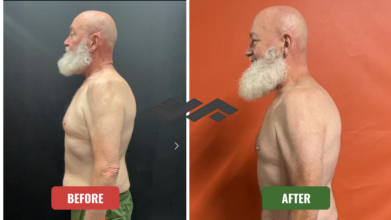 Before and After Image