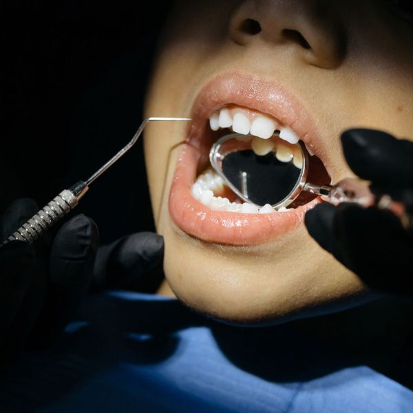 focus on childs teeth and dentist's mirror