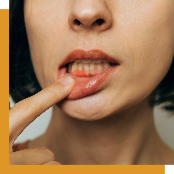Symptoms Periodontal Disease 1.png