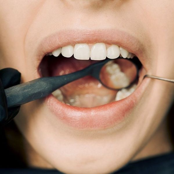 2How Can You Maintain Gum Health Between Dental Visits_How Can You Maintain Gum Health Between Dental Visits_2.jpg