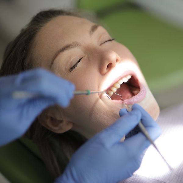dental cleaning dental cleaning
