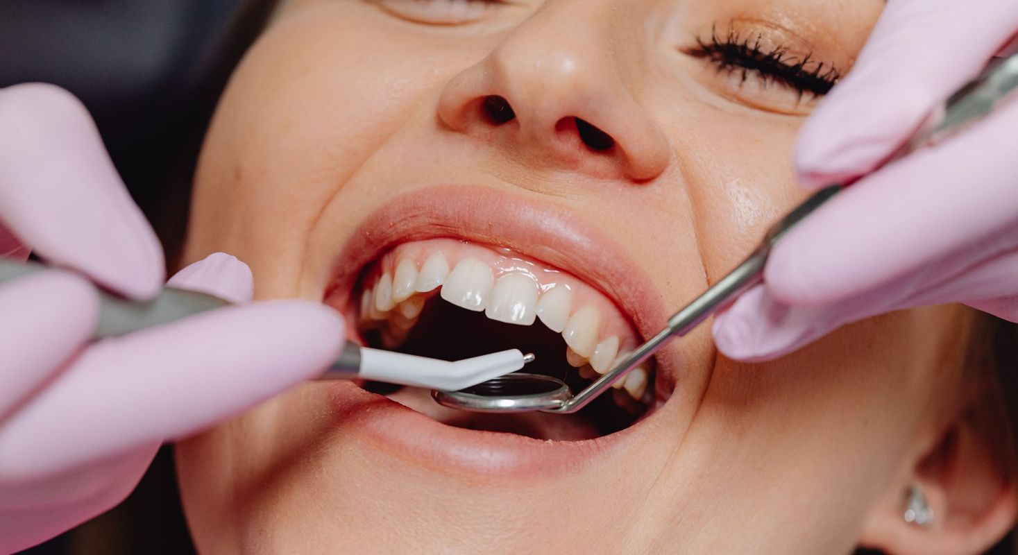 exam of gums 