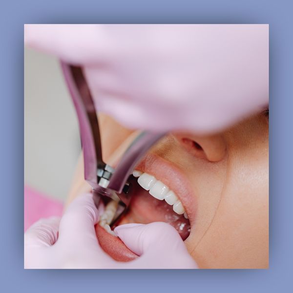 Dentist working in a patient's mouth